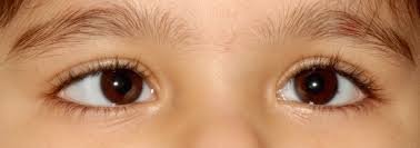 Squint 2 1