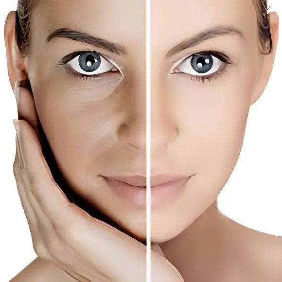 ocuplastic surgery ayaan 2