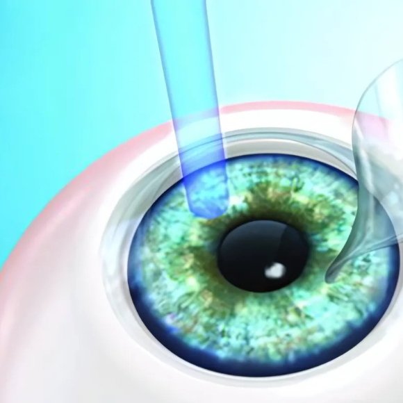 refractive img ayaan